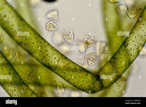  Vorticella! A Tiny Twirling Tornado of Freshwater