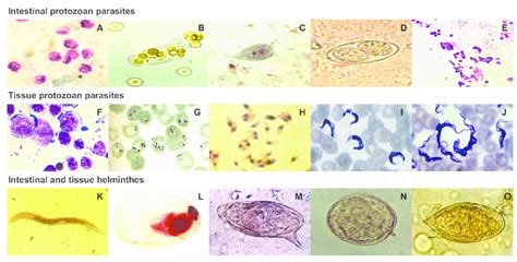  Cryptosporidium:  Parasitism Meets Microscopic Mayhem!